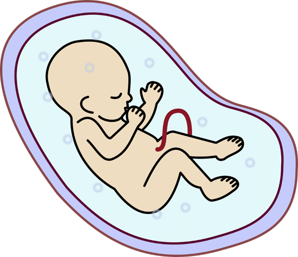amniotic fluid embolism