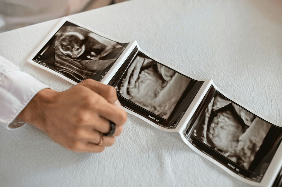 20 weeks pregnant in months