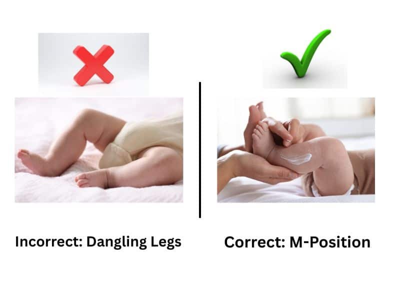Diagram showing correct M-position for baby hips versus incorrect dangling legs causing hip dysplasia.