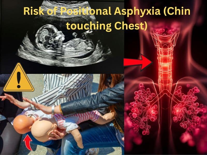 Warning diagram showing positional asphyxia risk when a baby's chin touches the chest, blocking the airway.